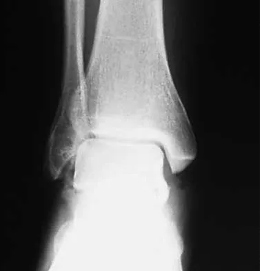 Trauma Board Review 2000: High-Yield MCQs (Set 4) - Figure 20