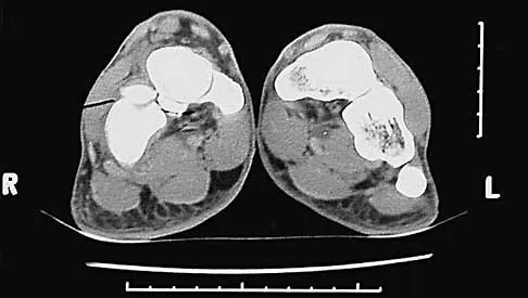 Trauma Board Review 2000: High-Yield MCQs (Set 4) - Figure 3