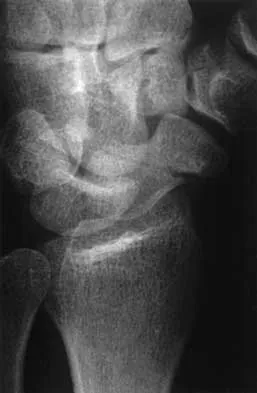 Trauma Board Review 2000: High-Yield MCQs (Set 4) - Figure 5