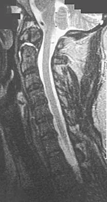 Trauma Board Review 2000: High-Yield MCQs (Set 4) - Figure 7