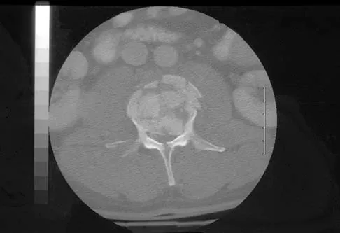 Trauma 2006 Practice Questions: Set 1 (Solved) - Figure 11
