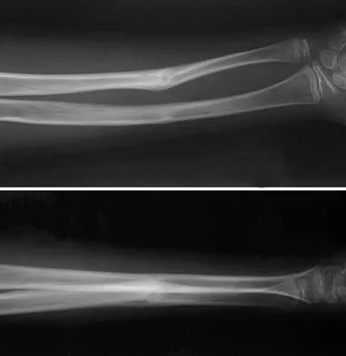 Trauma 2006 Practice Questions: Set 1 (Solved) - Figure 15