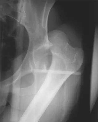 Trauma 2006 Practice Questions: Set 1 (Solved) - Figure 21