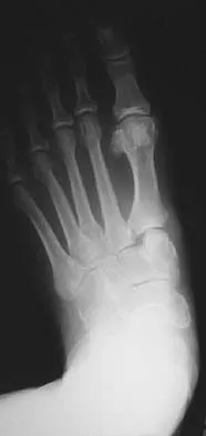 Trauma 2006 Practice Questions: Set 1 (Solved) - Figure 27