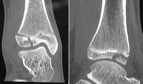Trauma 2006 Practice Questions: Set 1 (Solved) - Figure 33