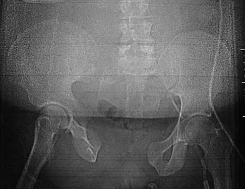 Trauma 2006 Practice Questions: Set 1 (Solved) - Figure 4