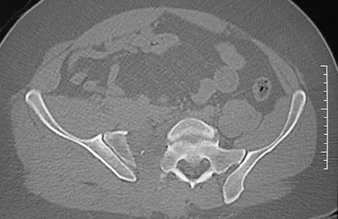 Trauma 2006 Practice Questions: Set 1 (Solved) - Figure 5