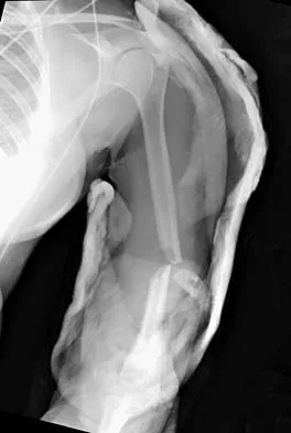 Trauma 2006 Practice Questions: Set 1 (Solved) - Figure 9