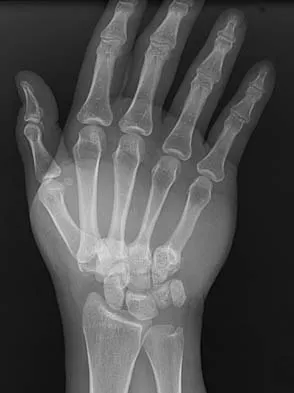 Trauma Board Review 2006: High-Yield MCQs (Set 2) - Figure 18