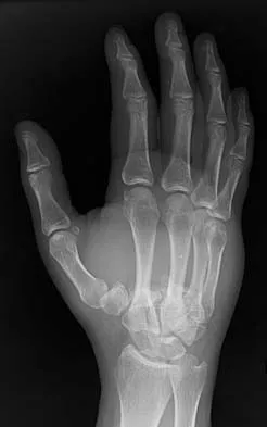 Trauma Board Review 2006: High-Yield MCQs (Set 2) - Figure 19