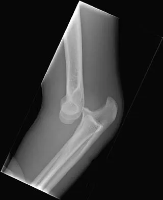 Trauma Board Review 2006: High-Yield MCQs (Set 2) - Figure 2