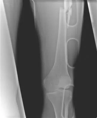 Trauma Board Review 2006: High-Yield MCQs (Set 2) - Figure 25