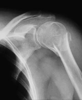 Trauma Board Review 2006: High-Yield MCQs (Set 2) - Figure 26