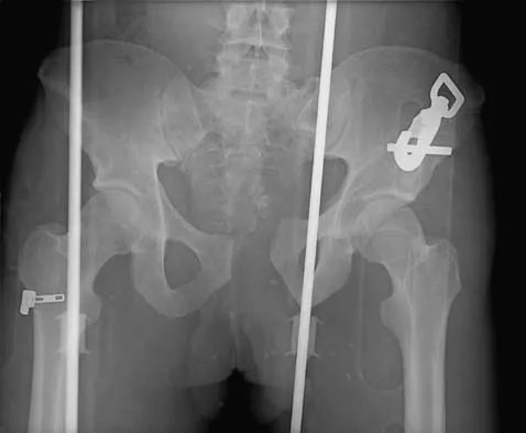 Trauma Board Review 2006: High-Yield MCQs (Set 2) - Figure 27