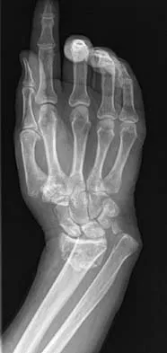 Trauma Board Review 2006: High-Yield MCQs (Set 2) - Figure 29