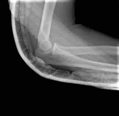 Trauma Board Review 2006: High-Yield MCQs (Set 2) - Figure 3