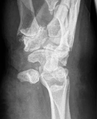 Trauma Board Review 2006: High-Yield MCQs (Set 2) - Figure 34