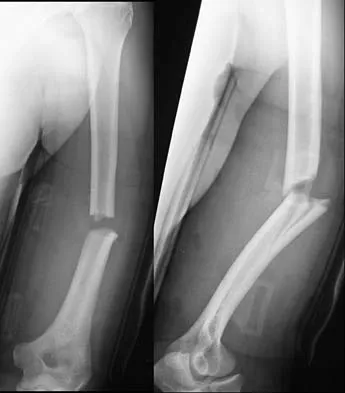 Trauma 2006 Practice Questions: Set 3 (Solved) - Figure 10