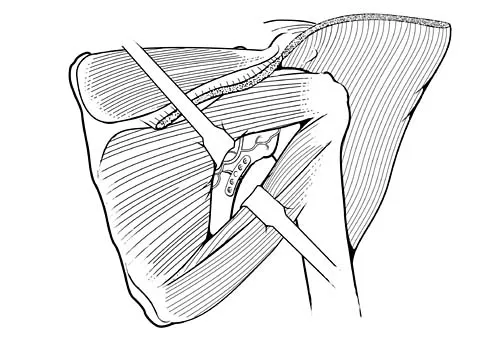 Trauma 2006 Practice Questions: Set 3 (Solved) - Figure 11