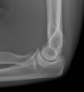 Trauma 2006 Practice Questions: Set 3 (Solved) - Figure 13