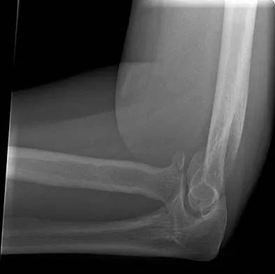 Trauma 2006 Practice Questions: Set 3 (Solved) - Figure 14