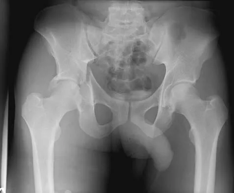 Trauma 2006 Practice Questions: Set 3 (Solved) - Figure 3