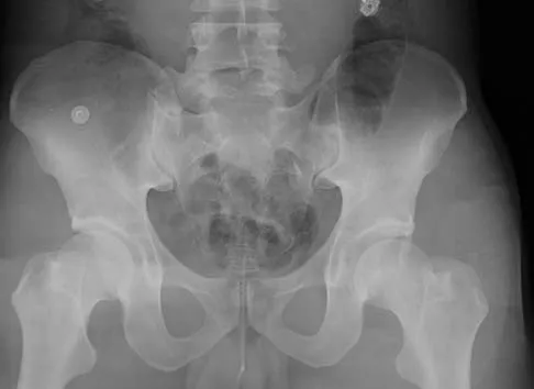 Trauma 2006 Practice Questions: Set 3 (Solved) - Figure 7