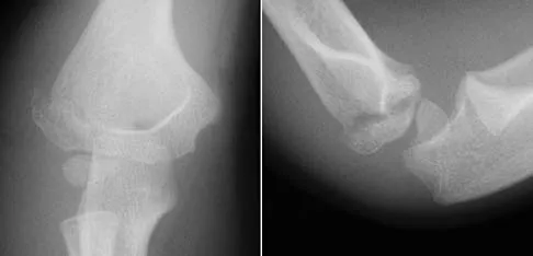 Trauma 2006 Practice Questions: Set 3 (Solved) - Figure 9