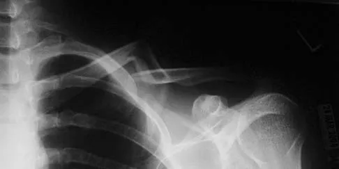 Trauma Board Review 2006: High-Yield MCQs (Set 4) - Figure 10