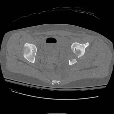 Trauma Board Review 2006: High-Yield MCQs (Set 4) - Figure 14