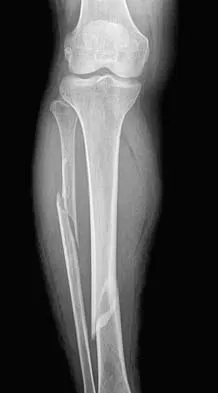 Trauma Board Review 2006: High-Yield MCQs (Set 4) - Figure 15