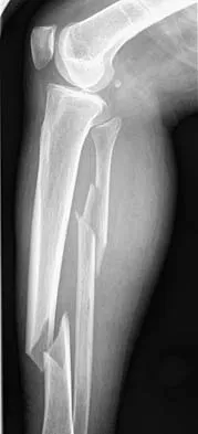 Trauma Board Review 2006: High-Yield MCQs (Set 4) - Figure 16