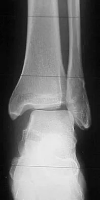 Trauma Board Review 2006: High-Yield MCQs (Set 4) - Figure 19
