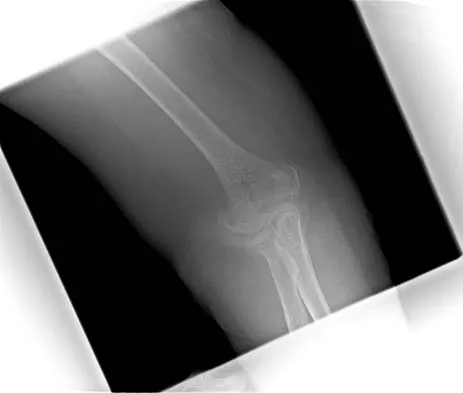 Trauma Board Review 2006: High-Yield MCQs (Set 4) - Figure 3
