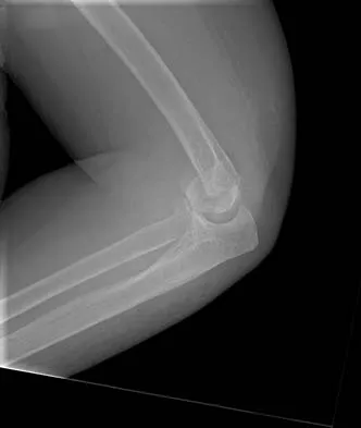Trauma Board Review 2006: High-Yield MCQs (Set 4) - Figure 4
