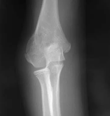 Trauma Board Review 2006: High-Yield MCQs (Set 4) - Figure 5