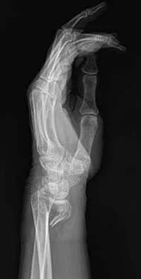 Trauma Board Review 2006: High-Yield MCQs (Set 4) - Figure 8