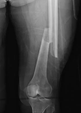 Trauma 2009 Practice Questions: Set 1 (Solved) - Figure 17