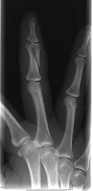 Trauma 2009 Practice Questions: Set 1 (Solved) - Figure 20