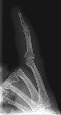 Trauma 2009 Practice Questions: Set 1 (Solved) - Figure 21