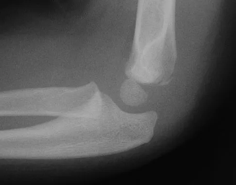 Trauma 2009 Practice Questions: Set 1 (Solved) - Figure 23
