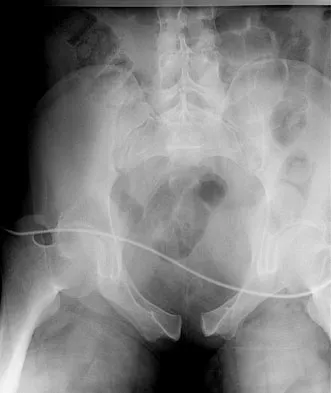 Trauma 2009 Practice Questions: Set 1 (Solved) - Figure 25