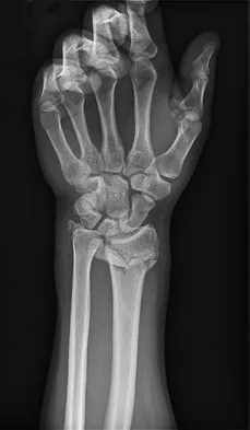 Trauma 2009 Practice Questions: Set 1 (Solved) - Figure 27