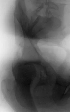 Trauma 2009 Practice Questions: Set 1 (Solved) - Figure 3
