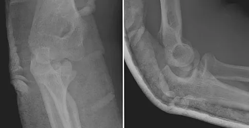 Trauma 2009 Practice Questions: Set 1 (Solved) - Figure 34