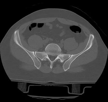 Trauma 2009 Practice Questions: Set 1 (Solved) - Figure 37