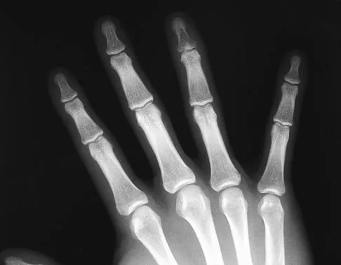 Trauma Board Review 2009: High-Yield MCQs (Set 2) - Figure 11