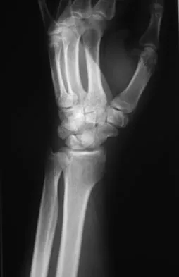 Trauma Board Review 2009: High-Yield MCQs (Set 2) - Figure 14