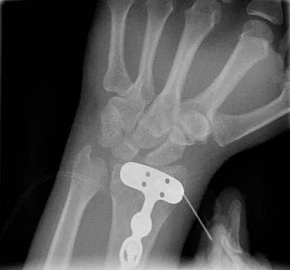 Trauma Board Review 2009: High-Yield MCQs (Set 2) - Figure 17