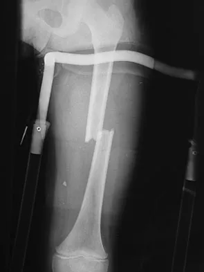 Trauma Board Review 2009: High-Yield MCQs (Set 2) - Figure 2